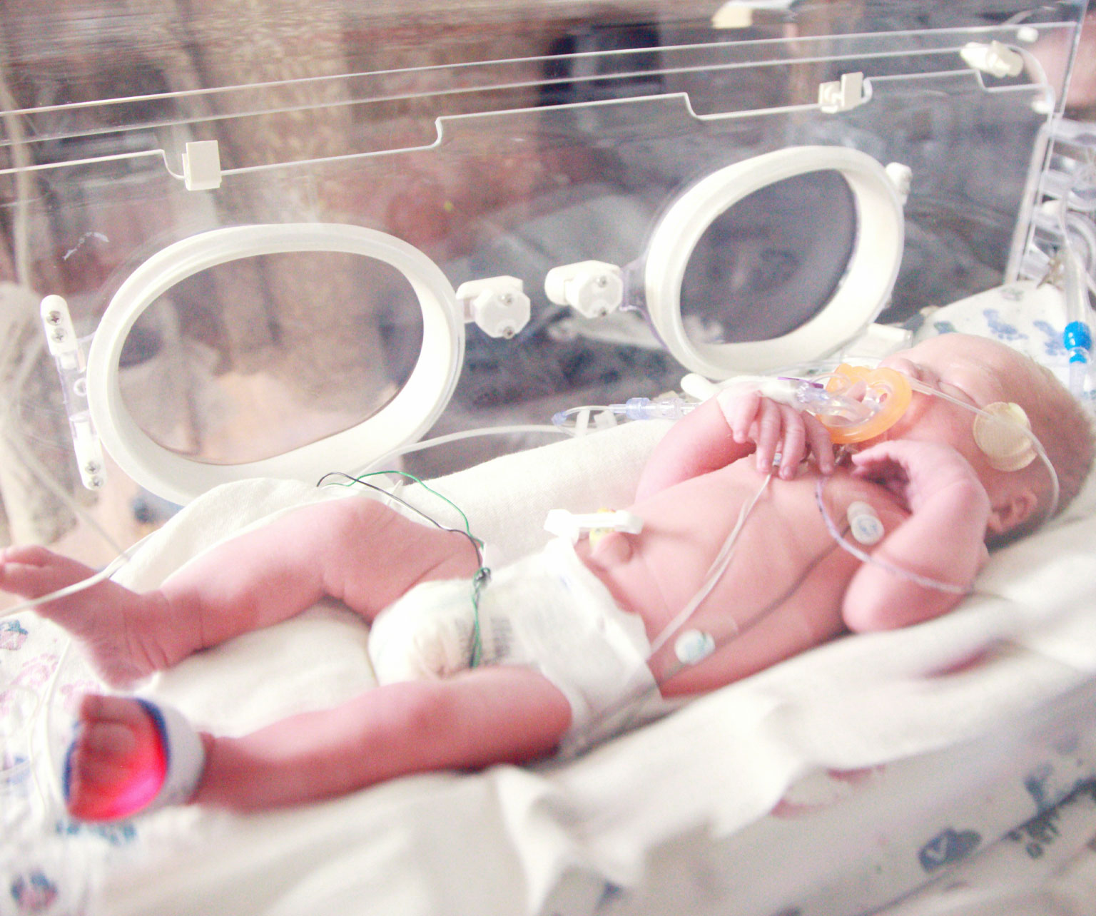 Can cord-blood stem cells prevent brain damage in preterm babies?